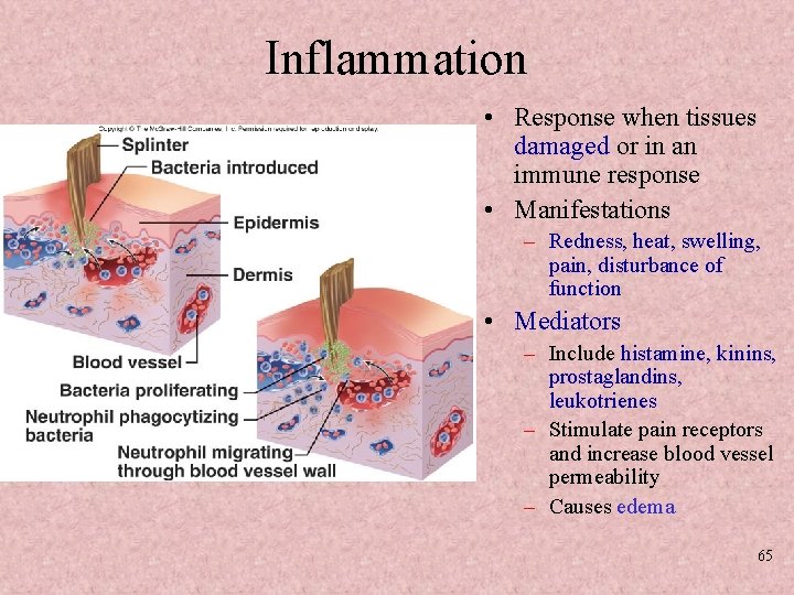 Inflammation • Response when tissues damaged or in an immune response • Manifestations –