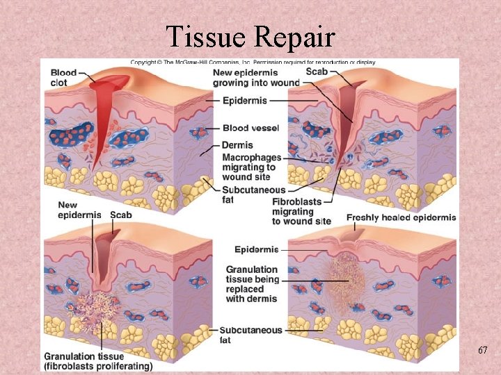 Tissue Repair 67 