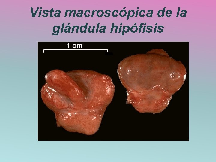 Vista macroscópica de la glándula hipófisis 