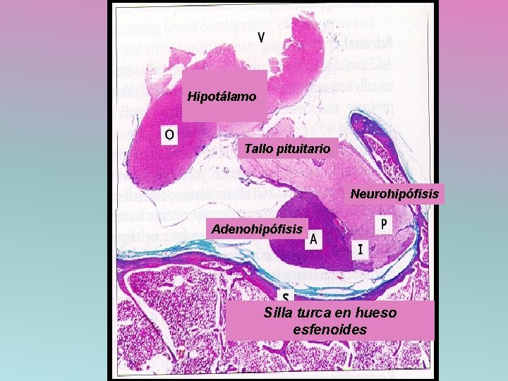 Hipotálamo Tallo pituitario Neurohipófisis Adenohipófisis Silla turca en hueso esfenoides 