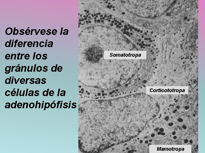 Obsérvese la diferencia entre los gránulos de diversas células de la adenohipófisis Somatotropa Corticototropa