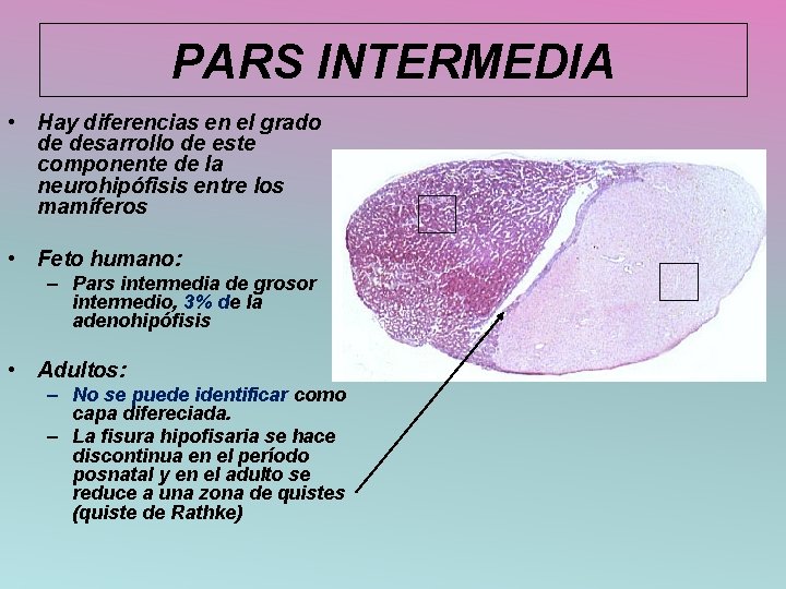 PARS INTERMEDIA • Hay diferencias en el grado de desarrollo de este componente de