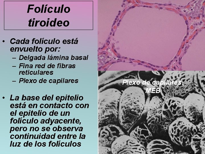 Folículo tiroideo • Cada folículo está envuelto por: – Delgada lámina basal – Fina