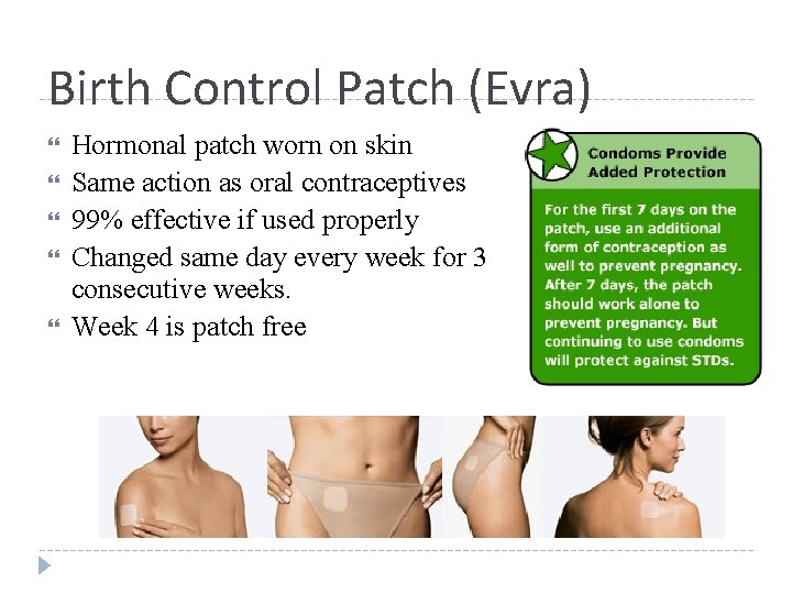 Birth Control Patch (Evra) Hormonal patch worn on skin Same action as oral contraceptives