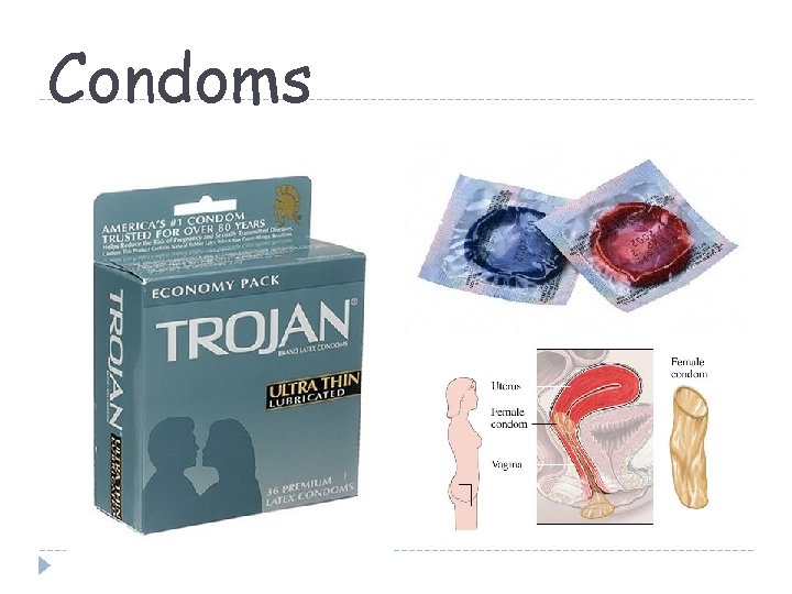 Condoms 