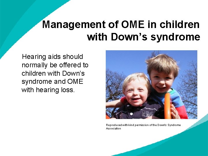 Management of OME in children with Down’s syndrome Hearing aids should normally be offered