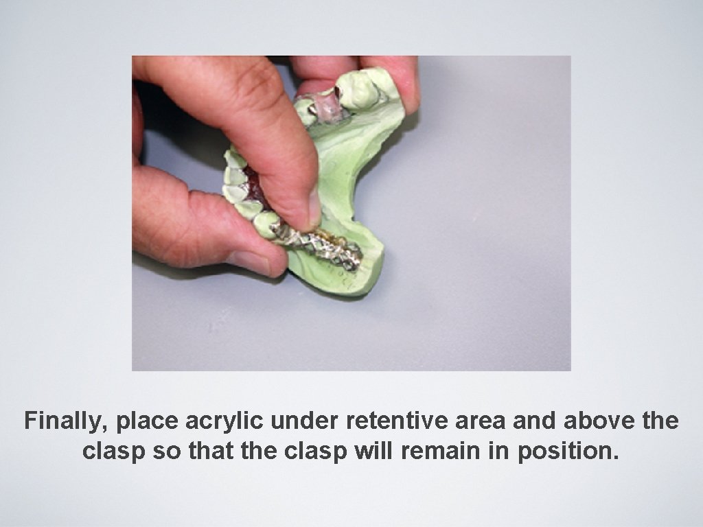 Finally, place acrylic under retentive area and above the clasp so that the clasp