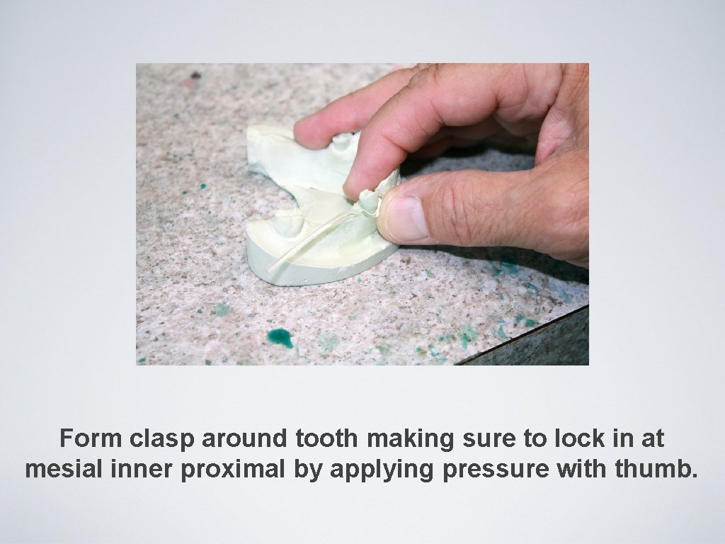 Form clasp around tooth making sure to lock in at mesial inner proximal by