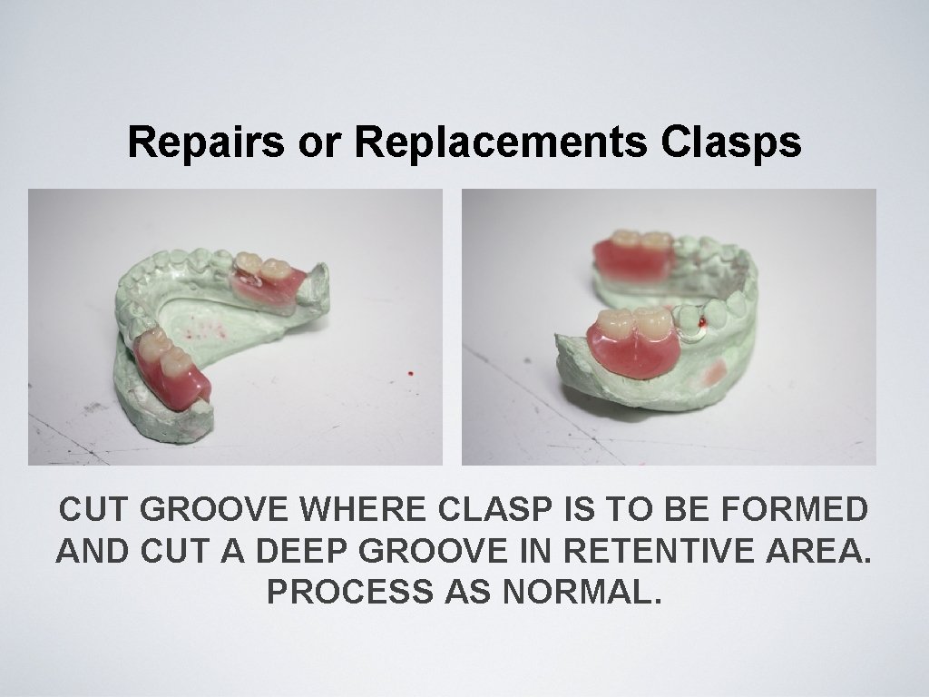 Repairs or Replacements Clasps CUT GROOVE WHERE CLASP IS TO BE FORMED AND CUT