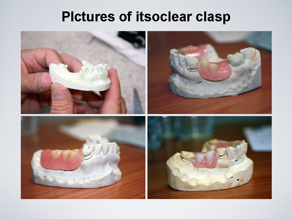 PIctures of itsoclear clasp 