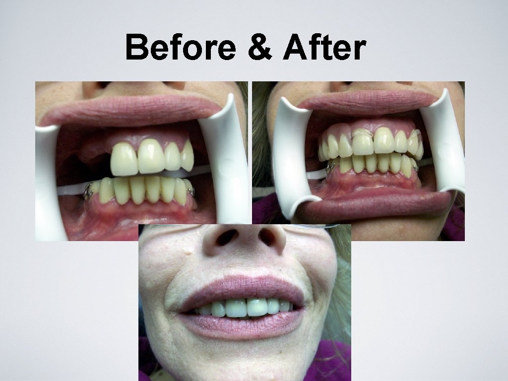 Before & After 