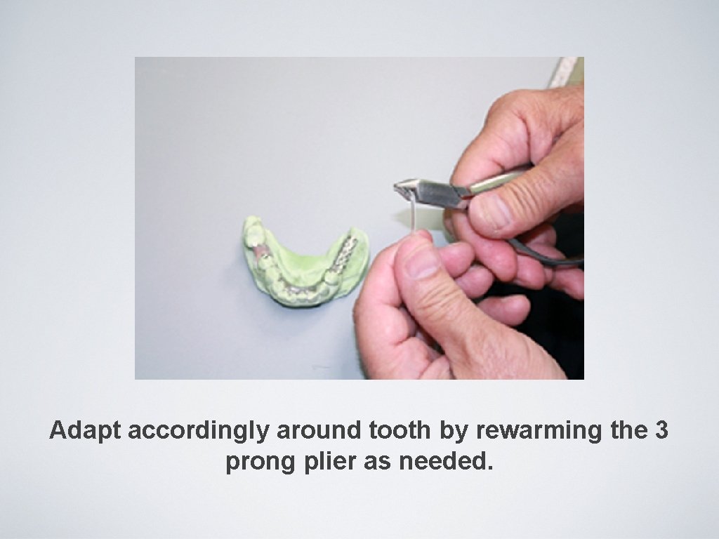 Adapt accordingly around tooth by rewarming the 3 prong plier as needed. 