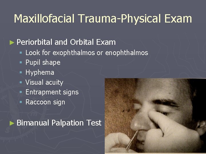 Maxillofacial Trauma-Physical Exam ► Periorbital § § § and Orbital Exam Look for exophthalmos