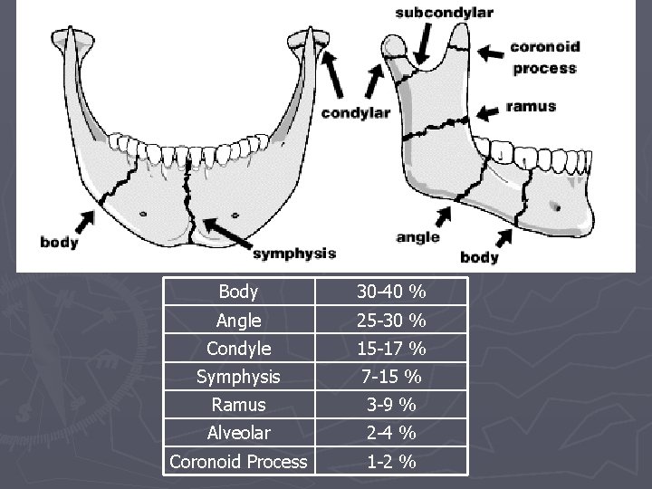 Body 30 -40 % Angle 25 -30 % Condyle 15 -17 % Symphysis 7