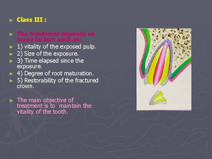 ► Class III : ► The treatment depends on many factors such as: 1)