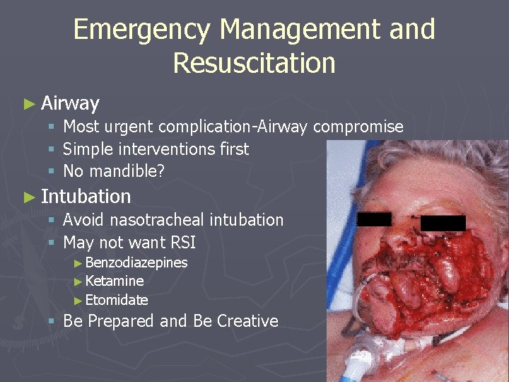 Emergency Management and Resuscitation ► Airway § Most urgent complication-Airway compromise § Simple interventions
