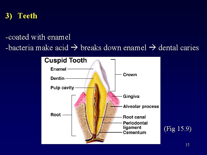 3) Teeth -coated with enamel -bacteria make acid breaks down enamel dental caries (Fig