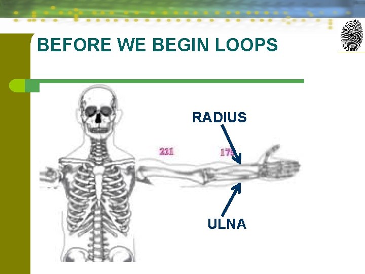 BEFORE WE BEGIN LOOPS RADIUS ULNA 10 