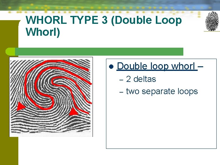 WHORL TYPE 3 (Double Loop Whorl) l Double loop whorl – – – 2