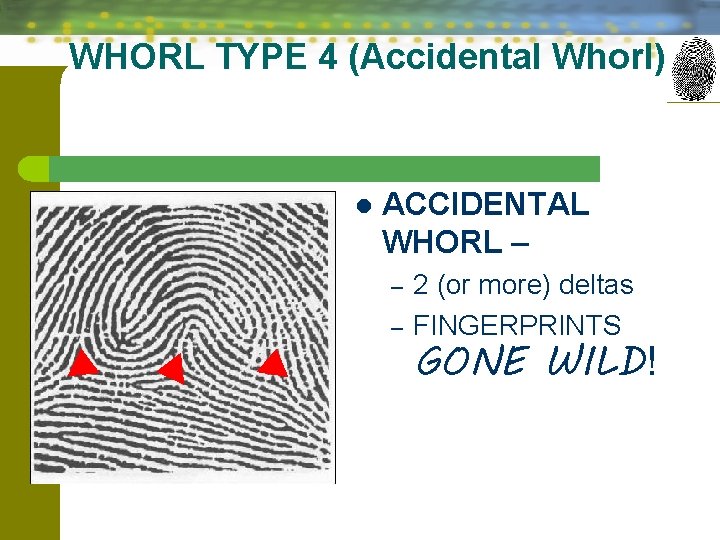 WHORL TYPE 4 (Accidental Whorl) l ACCIDENTAL WHORL – – – 2 (or more)