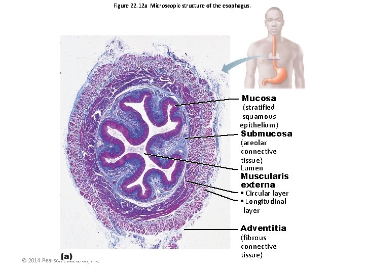 Figure 22. 12 a Microscopic structure of the esophagus. Mucosa (stratified squamous epithelium) Submucosa