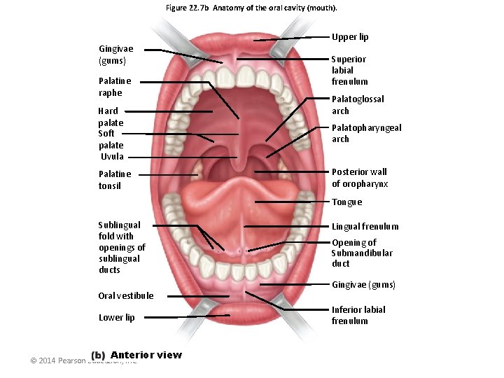 Figure 22. 7 b Anatomy of the oral cavity (mouth). Upper lip Gingivae (gums)