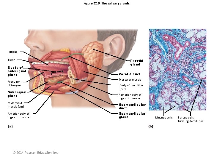 Figure 22. 9 The salivary glands. Tongue Teeth Ducts of sublingual gland Frenulum of