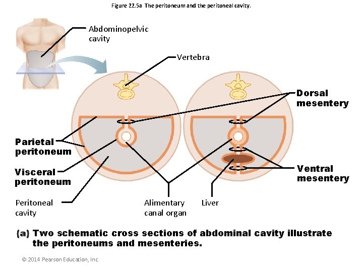 Figure 22. 5 a The peritoneum and the peritoneal cavity. Abdominopelvic cavity Vertebra Dorsal