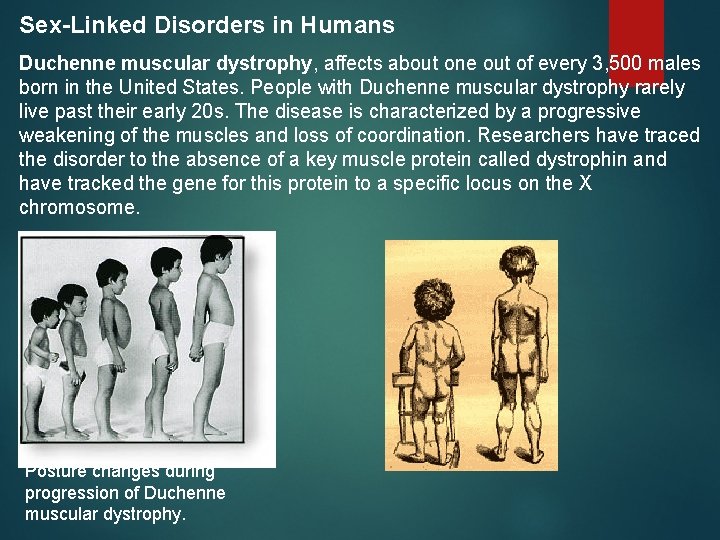 Sex-Linked Disorders in Humans Duchenne muscular dystrophy, affects about one out of every 3,