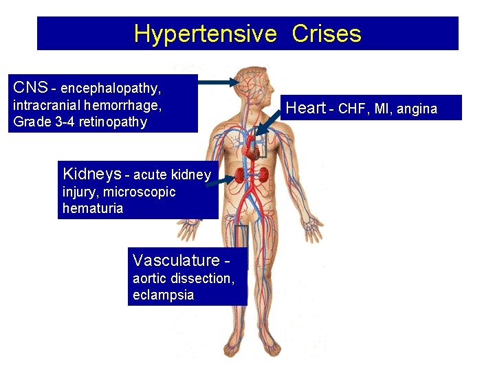 Hypertensive Crises CNS - encephalopathy, • Damage intracranial hemorrhage, Grade 3 -4 retinopathy Kidneys