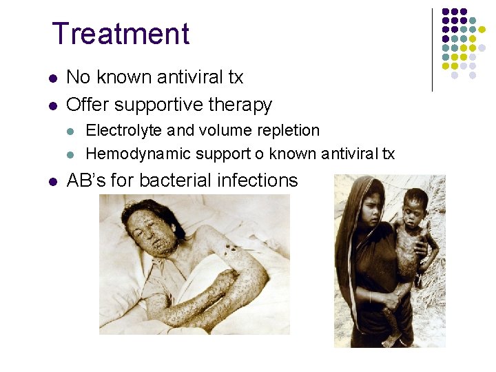 Treatment l l No known antiviral tx Offer supportive therapy l l l Electrolyte
