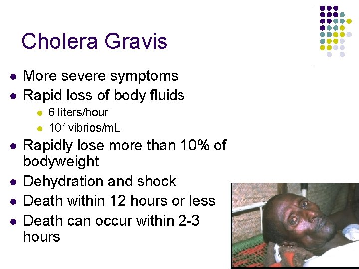 Cholera Gravis l l More severe symptoms Rapid loss of body fluids l l