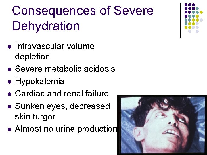 Consequences of Severe Dehydration l l l Intravascular volume depletion Severe metabolic acidosis Hypokalemia