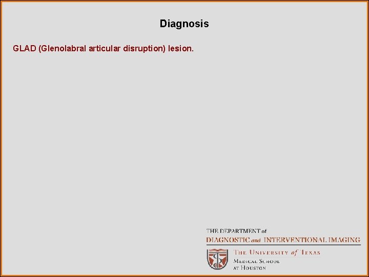 Diagnosis GLAD (Glenolabral articular disruption) lesion. 