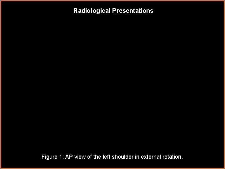 Radiological Presentations Figure 1: AP view of the left shoulder in external rotation. 