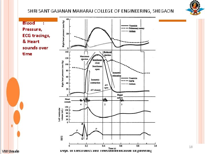 SHRI SANT GAJANAN MAHARAJ COLLEGE OF ENGINEERING, SHEGAON : Blood Pressure, ECG tracings, &