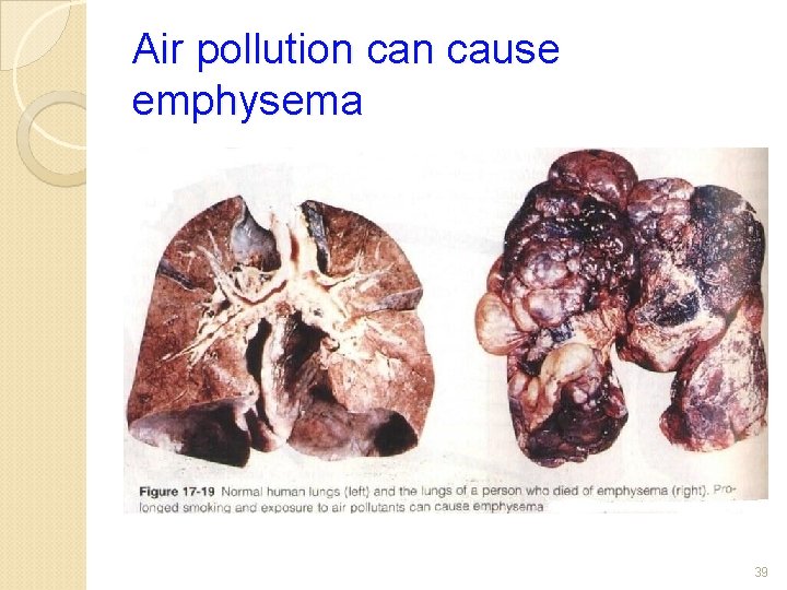 Air pollution cause emphysema 39 