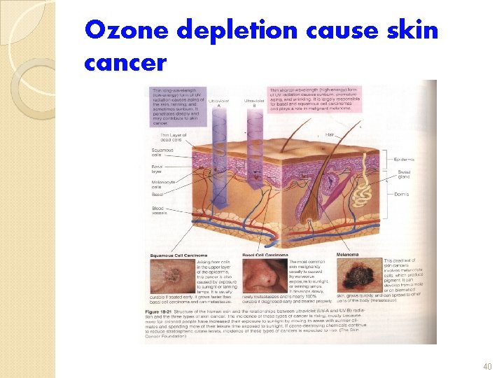 Ozone depletion cause skin cancer 40 