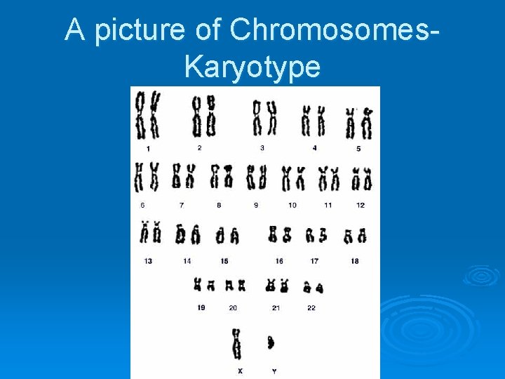 A picture of Chromosomes. Karyotype 