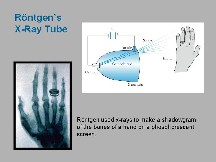 Röntgen’s X-Ray Tube Röntgen used x-rays to make a shadowgram of the bones of