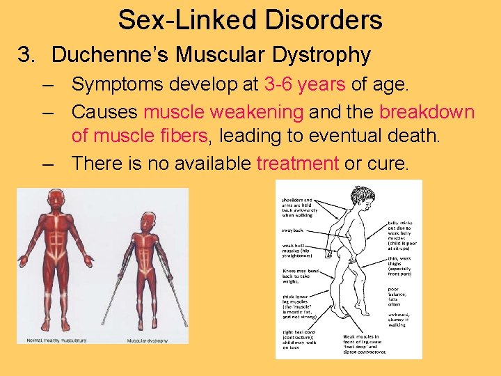 Sex-Linked Disorders 3. Duchenne’s Muscular Dystrophy – Symptoms develop at 3 -6 years of