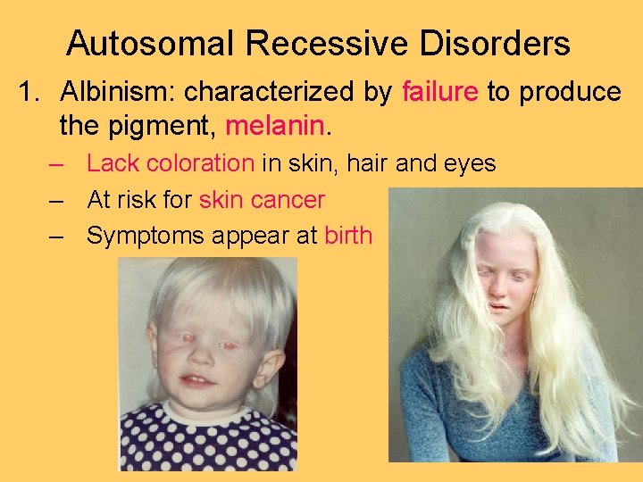 Autosomal Recessive Disorders 1. Albinism: characterized by failure to produce the pigment, melanin. –