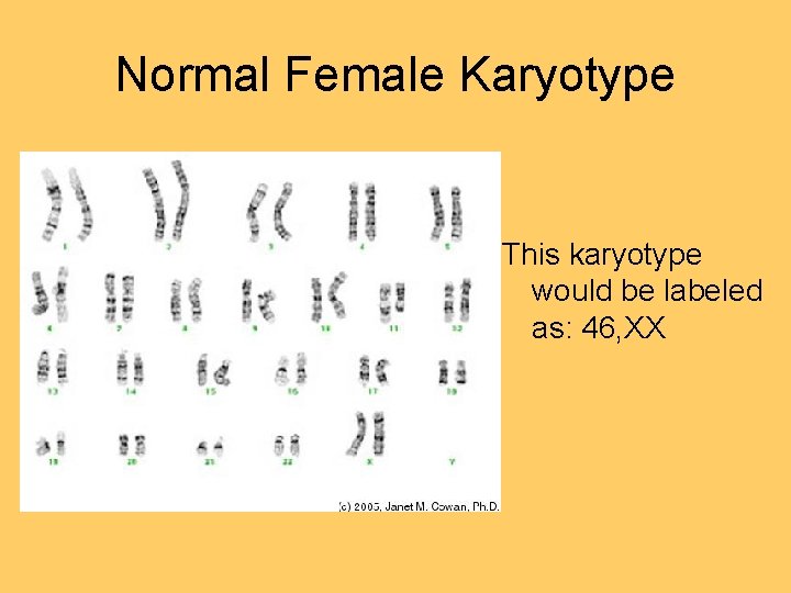 Normal Female Karyotype This karyotype would be labeled as: 46, XX 