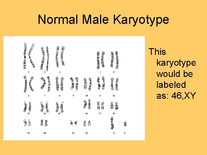 Normal Male Karyotype This karyotype would be labeled as: 46, XY Normal Male Karyotype This karyotype would be labeled as: 46, XY