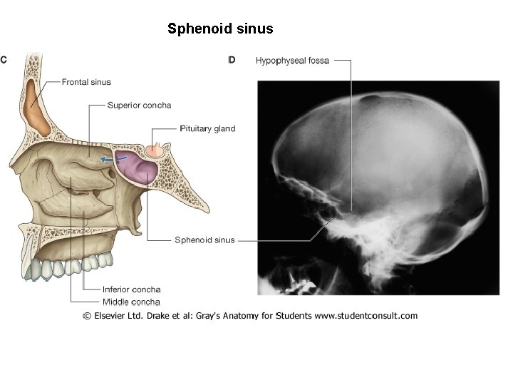 Sphenoid sinus 