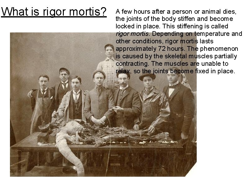 What is rigor mortis? A few hours after a person or animal dies, the