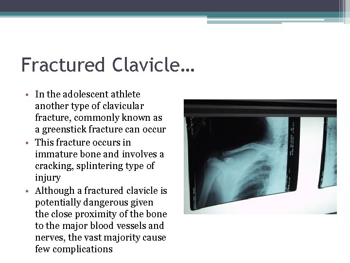 Fractured Clavicle… • In the adolescent athlete another type of clavicular fracture, commonly known