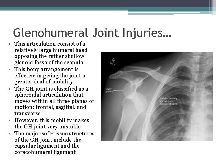 Glenohumeral Joint Injuries… • This articulation consist of a relatively large humeral head opposing