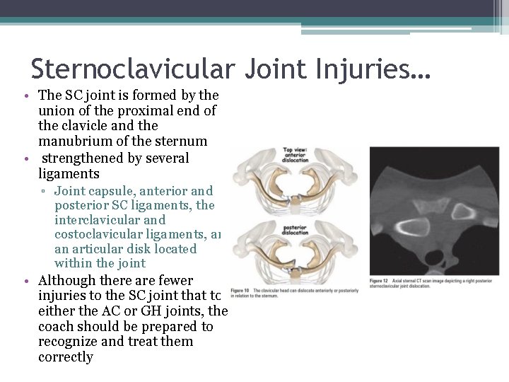 Sternoclavicular Joint Injuries… • The SC joint is formed by the union of the