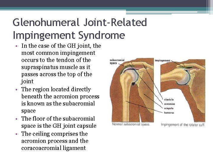 Glenohumeral Joint-Related Impingement Syndrome • In the case of the GH joint, the most